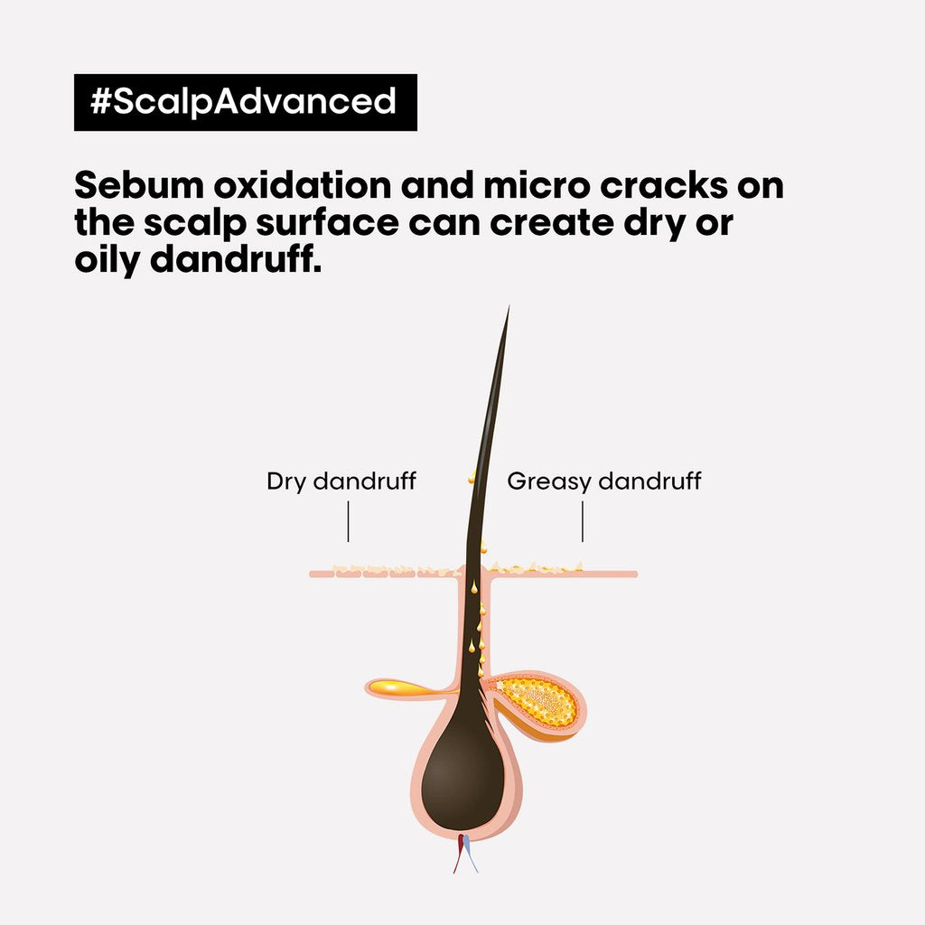 L'oreal Professionnel Scalp Advanced Anti-Oiliness Mask 250ml