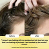 Bondi Boost Lock Drops Anti Shedding Scalp and Hair Serum 30ml