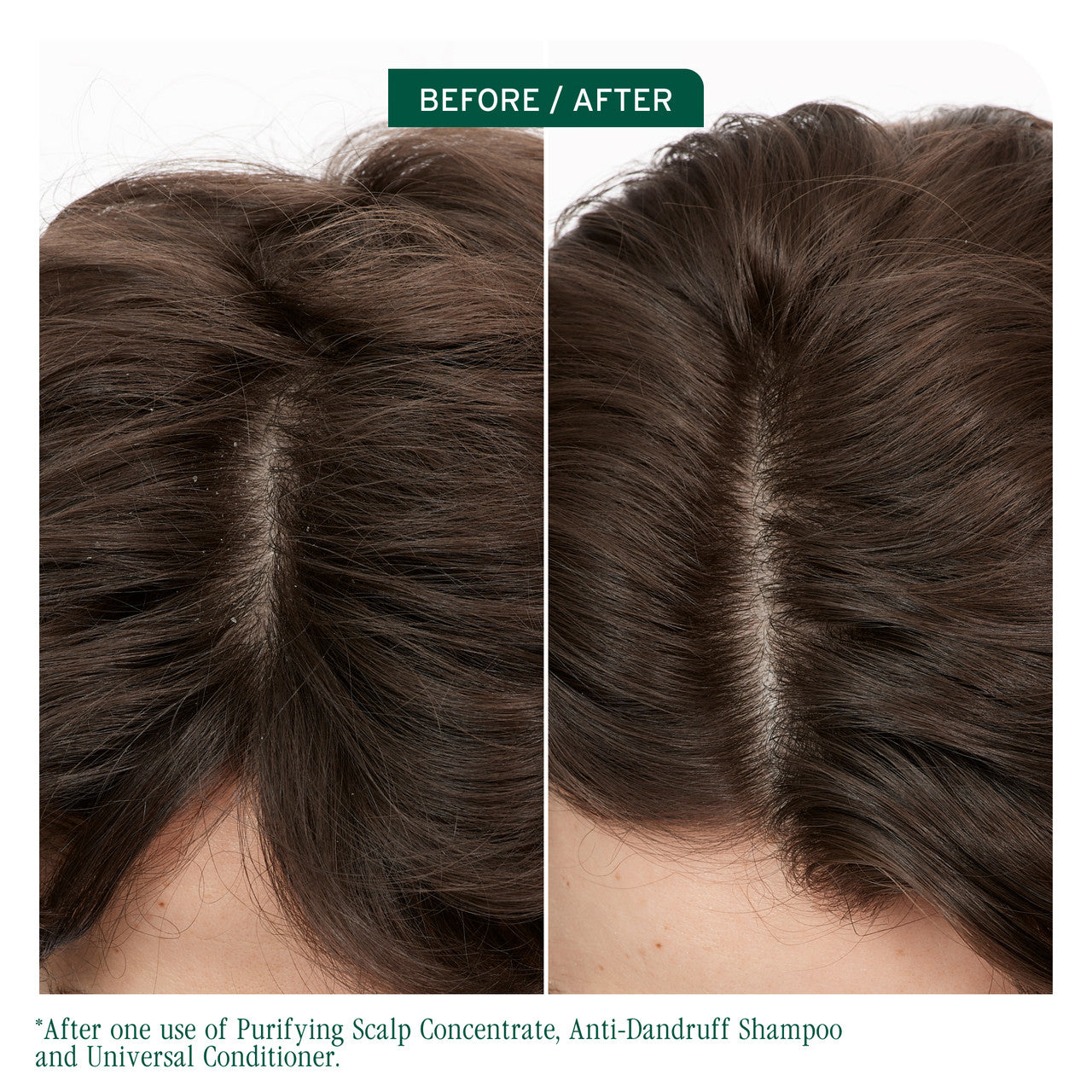 Matrix Biolage Scalp Sync Dandruff Prone Scalp Care Trio Bundle