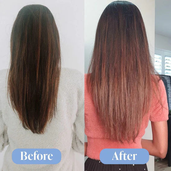 Natural Look Anti-Hair Loss Treatment Bundle